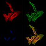 RhoB Polyclonal Antibody