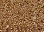 RhoB Antibody in Immunohistochemistry (Paraffin) (IHC (P))