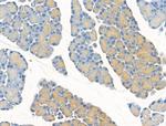 RPL26 Antibody in Immunohistochemistry (Paraffin) (IHC (P))