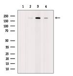 RICTOR Polyclonal Antibody