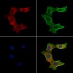 S100A3 Antibody in Immunocytochemistry (ICC/IF)