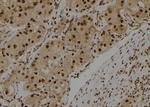 S100A3 Antibody in Immunohistochemistry (Paraffin) (IHC (P))