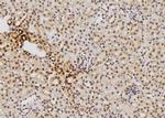 S100 Polyclonal Antibody