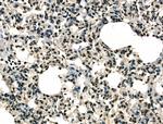 STAG1 Antibody in Immunohistochemistry (Paraffin) (IHC (P))