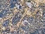 STAG1 Antibody in Immunohistochemistry (Paraffin) (IHC (P))