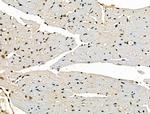 STAG1 Polyclonal Antibody