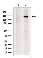STAG1 Antibody in Western Blot (WB)