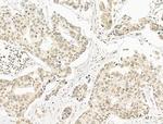 SF3B1 Antibody in Immunohistochemistry (Paraffin) (IHC (P))