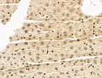 SF3B1 Antibody in Immunohistochemistry (Paraffin) (IHC (P))