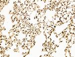 SF3B1 Antibody in Immunohistochemistry (Paraffin) (IHC (P))
