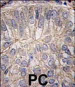 P-cadherin Polyclonal Antibody