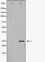 SCN4B Polyclonal Antibody
