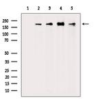 SCRIB Polyclonal Antibody