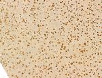 SCXA Antibody in Immunohistochemistry (Paraffin) (IHC (P))