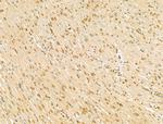 SCXA Antibody in Immunohistochemistry (Paraffin) (IHC (P))