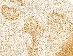 SCXA Antibody in Immunohistochemistry (Paraffin) (IHC (P))