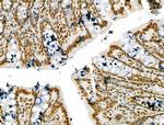 SCXA Antibody in Immunohistochemistry (Paraffin) (IHC (P))