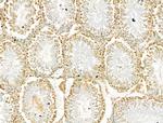 SCXA Antibody in Immunohistochemistry (Paraffin) (IHC (P))