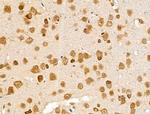 SDCCAG3 Isoform 1 Antibody in Immunohistochemistry (Paraffin) (IHC (P))