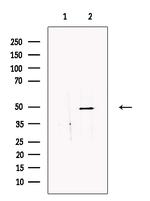 SDCCAG3 Isoform 1 Antibody in Western Blot (WB)