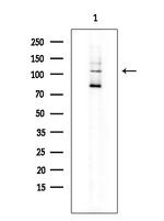 SEMA4B Polyclonal Antibody