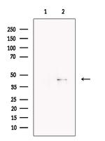 SERPINB1 Polyclonal Antibody