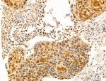 SET Antibody in Immunohistochemistry (Paraffin) (IHC (P))