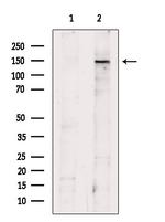 SFRS15 Polyclonal Antibody