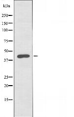 SIRT3 Polyclonal Antibody