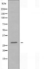 SIX6 Polyclonal Antibody