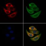 SLC10A7 Polyclonal Antibody