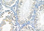 SLC10A7 Antibody in Immunohistochemistry (Paraffin) (IHC (P))