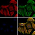 SLC22A6 Polyclonal Antibody