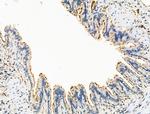 CTR1 Polyclonal Antibody