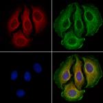 SLCO1C1 Polyclonal Antibody