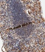 TLR2 Polyclonal Antibody