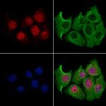 SLFN11 Antibody in Immunocytochemistry (ICC/IF)
