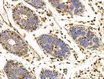 SLFN11 Antibody in Immunohistochemistry (Paraffin) (IHC (P))