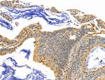 SLFN11 Antibody in Immunohistochemistry (Paraffin) (IHC (P))