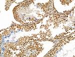 SLFN11 Antibody in Immunohistochemistry (Paraffin) (IHC (P))