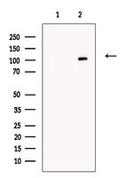 SLFN11 Antibody in Western Blot (WB)