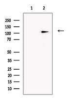 SLFN14 Polyclonal Antibody