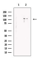 SSH1 Antibody in Western Blot (WB)