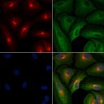 SLIT2 Polyclonal Antibody