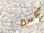 TAGLN Antibody in Immunohistochemistry (Paraffin) (IHC (P))