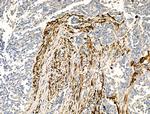 TAGLN Antibody in Immunohistochemistry (Paraffin) (IHC (P))