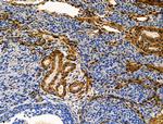 TAGLN Antibody in Immunohistochemistry (Paraffin) (IHC (P))