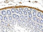 TAGLN Antibody in Immunohistochemistry (Paraffin) (IHC (P))