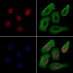 SMARCA1 Polyclonal Antibody