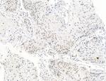 SMARCA1 Antibody in Immunohistochemistry (Paraffin) (IHC (P))
